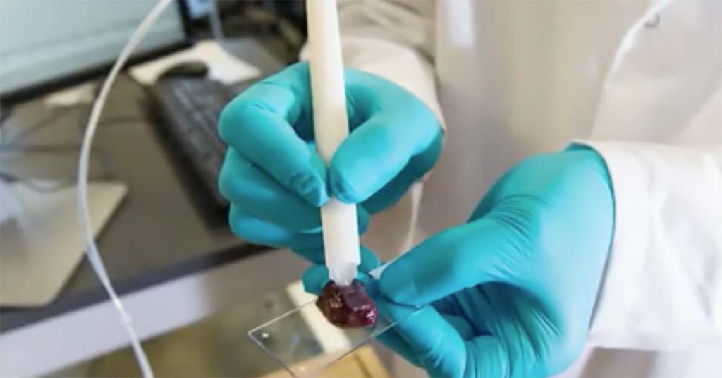 Thiết bị MasSpec Pen, còn được gọi là “bút phát hiện ung thư. Ảnh: Quazmedia.com