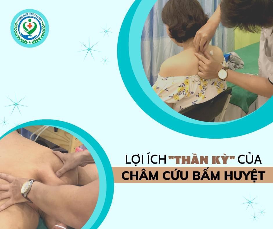 Phương pháp châm cứu có điều trị được mất ngủ không?