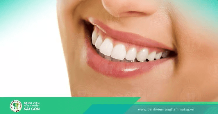 Bảng giá trồng răng implant bao nhiêu? Trồng răng implant ở đâu là tốt nhất?